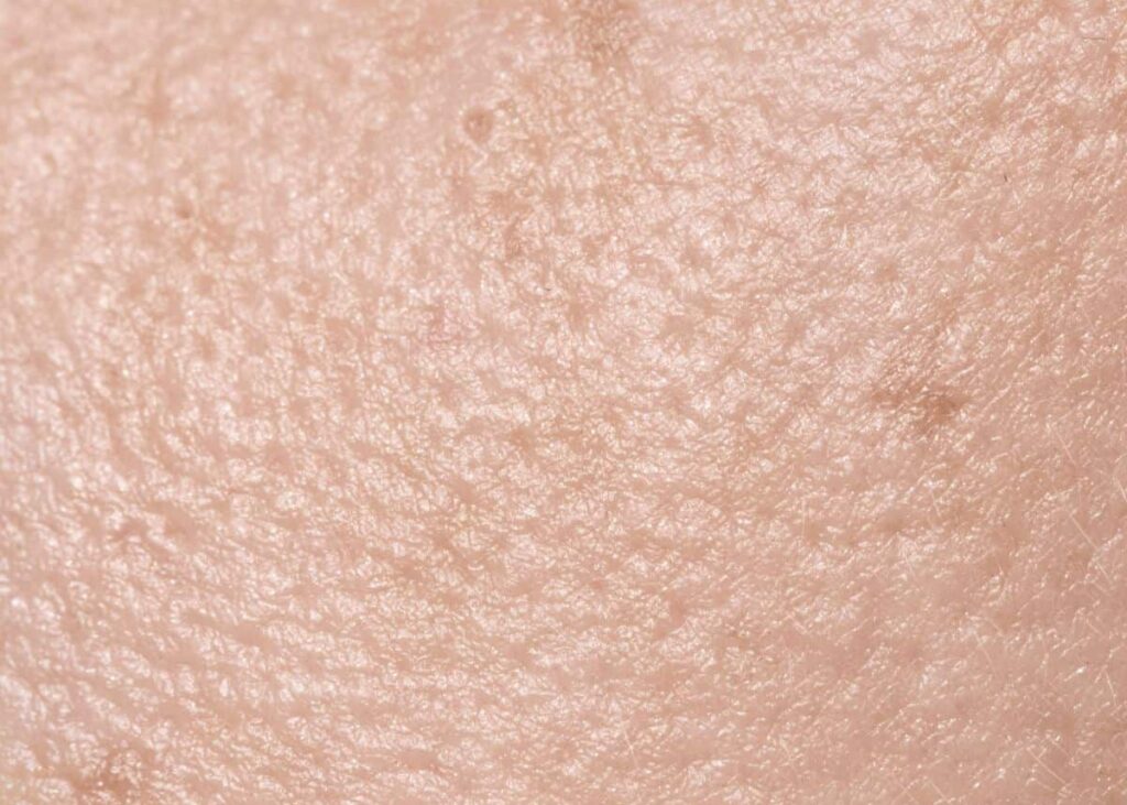 Foto jarak dekat tekstur kulit manusia yang menunjukkan pori-pori dan sedikit pigmentasi